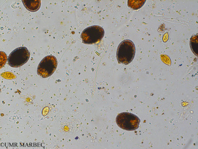 phyto/Pertuis Charentais/Ars_st2/PAMPAS 2019-2021/Aphanothece sp3 (FIERDARS_St2_r1_0719-030).tif(copy)_thumb.jpg